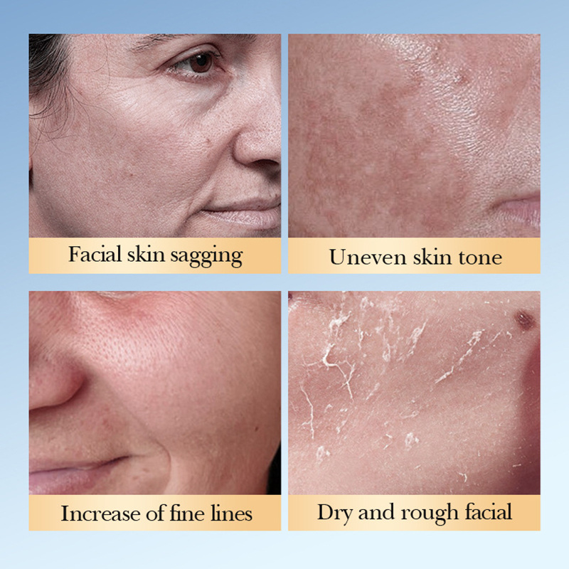 SADOER Glykolsäure Toner Gesic – Lactic Acid Toner Bewertung und Preis